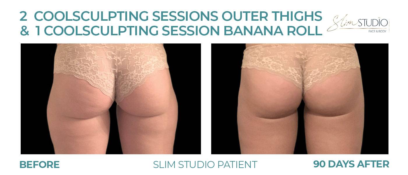 Slim Studio Buckhead photo 3